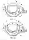 Fig. 08 - Surgical suturing apparatus