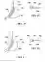 Fig. 32 - Surgical suturing apparatus