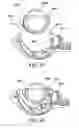 Fig. 34 - Surgical suturing apparatus