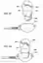 Fig. 35 - Surgical suturing apparatus