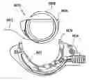 Fig. 01 - Quick load mechanism for a surgical suturing apparatus