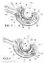 Fig. 03 - Quick load mechanism for a surgical suturing apparatus