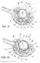 Fig. 06 - Quick load mechanism for a surgical suturing apparatus