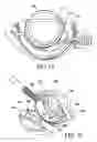Fig. 10 - Quick load mechanism for a surgical suturing apparatus