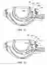 Fig. 15 - Quick load mechanism for a surgical suturing apparatus