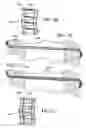 Fig. 30 - Quick load mechanism for a surgical suturing apparatus