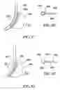 Fig. 32 - Quick load mechanism for a surgical suturing apparatus