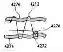 Fig. 01 - Method for suture lacing