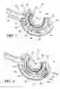 Fig. 03 - Method for suture lacing