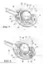 Fig. 05 - Method for suture lacing