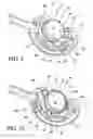 Fig. 06 - Method for suture lacing