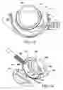 Fig. 10 - Method for suture lacing