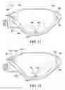 Fig. 11 - Method for suture lacing