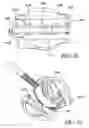Fig. 14 - Method for suture lacing