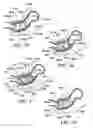 Fig. 25 - Method for suture lacing