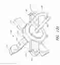 Fig. 22 - Method and apparatus for holding suture ends to facilitate tying of knots