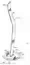 Fig. 01 - Implantable prosthesis