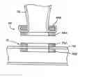 Fig. 01 - Devices and methods for forming magnetic anastomoses between vessels
