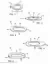 Fig. 02 - Devices and methods for forming magnetic anastomoses between vessels