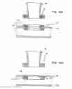 Fig. 05 - Devices and methods for forming magnetic anastomoses between vessels