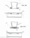 Fig. 06 - Devices and methods for forming magnetic anastomoses between vessels