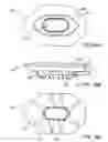 Fig. 30 - Devices and methods for forming magnetic anastomoses between vessels