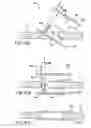 Fig. 34 - Devices and methods for forming magnetic anastomoses between vessels