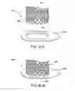 Fig. 41 - Devices and methods for forming magnetic anastomoses between vessels