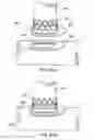 Fig. 47 - Devices and methods for forming magnetic anastomoses between vessels