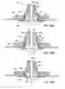 Fig. 55 - Devices and methods for forming magnetic anastomoses between vessels