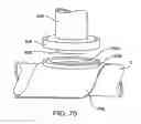 Fig. 59 - Devices and methods for forming magnetic anastomoses between vessels