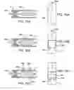 Fig. 64 - Devices and methods for forming magnetic anastomoses between vessels