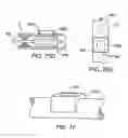 Fig. 65 - Devices and methods for forming magnetic anastomoses between vessels