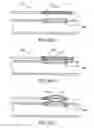 Fig. 70 - Devices and methods for forming magnetic anastomoses between vessels