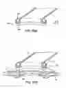 Fig. 72 - Devices and methods for forming magnetic anastomoses between vessels