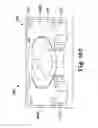 Fig. 83 - Devices and methods for forming magnetic anastomoses between vessels