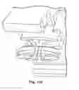 Fig. 90 - Devices and methods for forming magnetic anastomoses between vessels