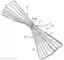Fig. 01 - Intragastric device for treating obesity