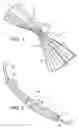 Fig. 02 - Intragastric device for treating obesity