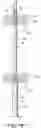 Fig. 09 - Intragastric device for treating obesity