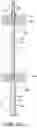 Fig. 12 - Intragastric device for treating obesity
