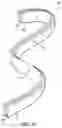 Fig. 19 - Intragastric device for treating obesity