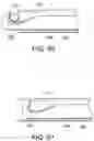 Fig. 32 - Intragastric device for treating obesity