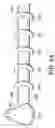 Fig. 34 - Intragastric device for treating obesity