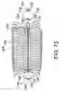 Fig. 44 - Intragastric device for treating obesity