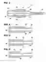 Fig. 03 - Mechanically expandable distal protection apparatus and method of use