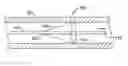Fig. 01 - Thin film vessel occlusion device