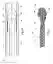 Fig. 03 - SHEATH FOR USE WITH AN EMBOLIC PROTECTION FILTERING PROTECTION