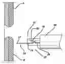 Fig. 01 - Medical stapler