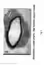 Fig. 09 - Electrical devices and anti-scarring agents